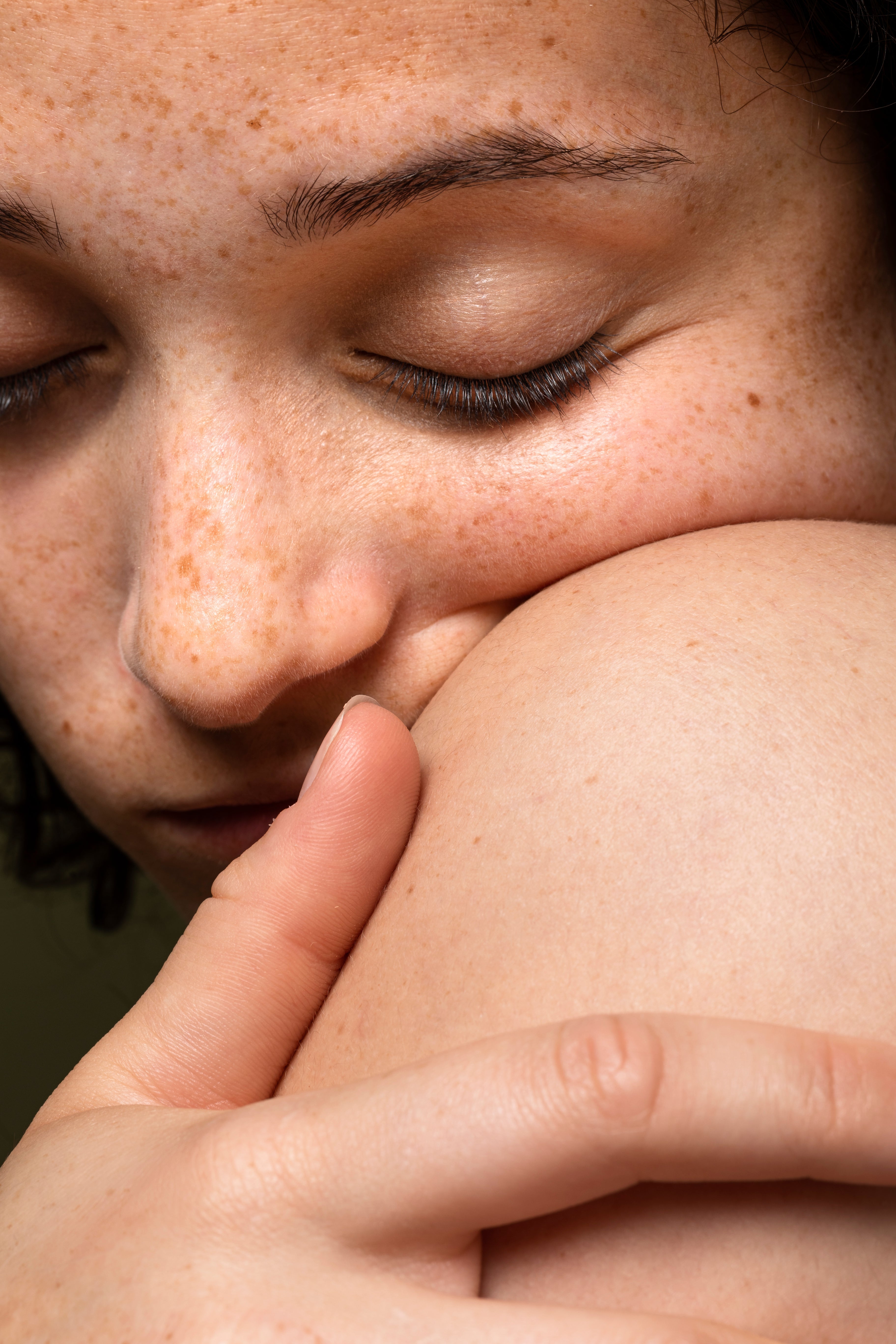 Dry Skin